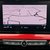 Vauxhall Mokka 1.2 Turbo 100 SRi Nav Premium 5dr 23